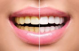 teeth